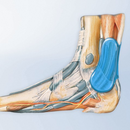 Bauerfeind AchilloTrain