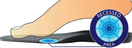 DonJoy Arch Rival Orthotic